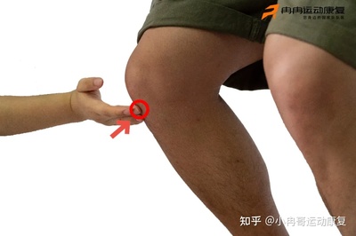 髌骨疼痛怎么治疗