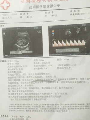 30周胎儿存活率