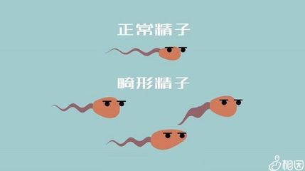 畸形精子症怎么治疗