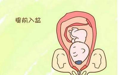 胎儿一直不入盆怎么办