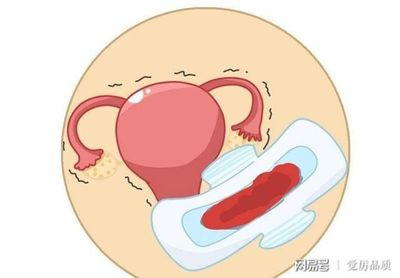 不是排卵期出血是怎么回事