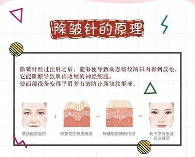 除皱原理