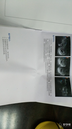 怀孕6周是多少天了