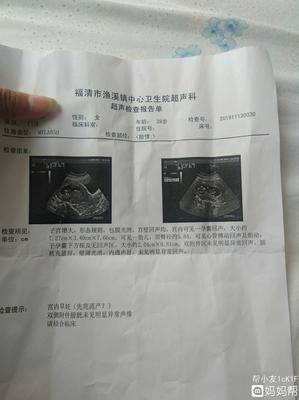结扎三年了还会怀孕吗