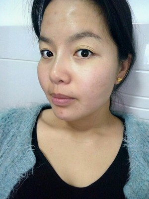 水光针可以打鼻子吗