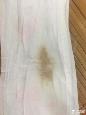 白带有点咖啡色是怎么回事