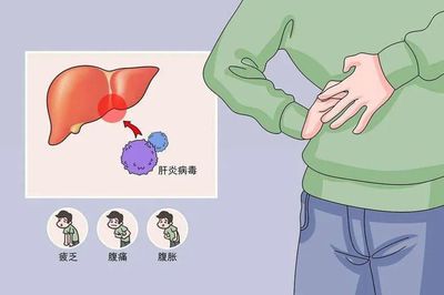 肝炎怎么治疗最好的方法