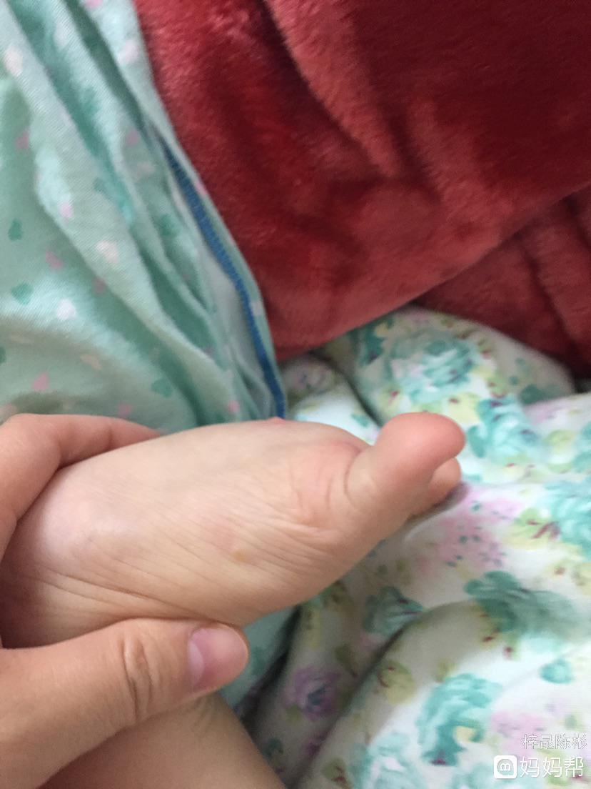 宝宝老是搓脚怎么回事