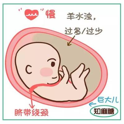 如何知道胎儿是否缺氧