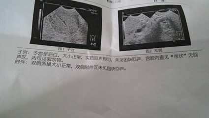 宫腔积血是怎么回事