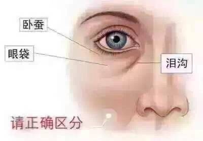 眼部眼带怎么形成原因