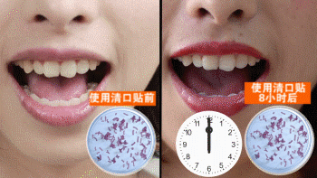 口臭 胃 口腔