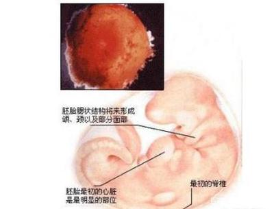 一个月会有孕吐吗