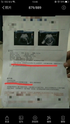 怀孕36周是多少个月