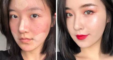 用了遮瑕后脸上长痘痘