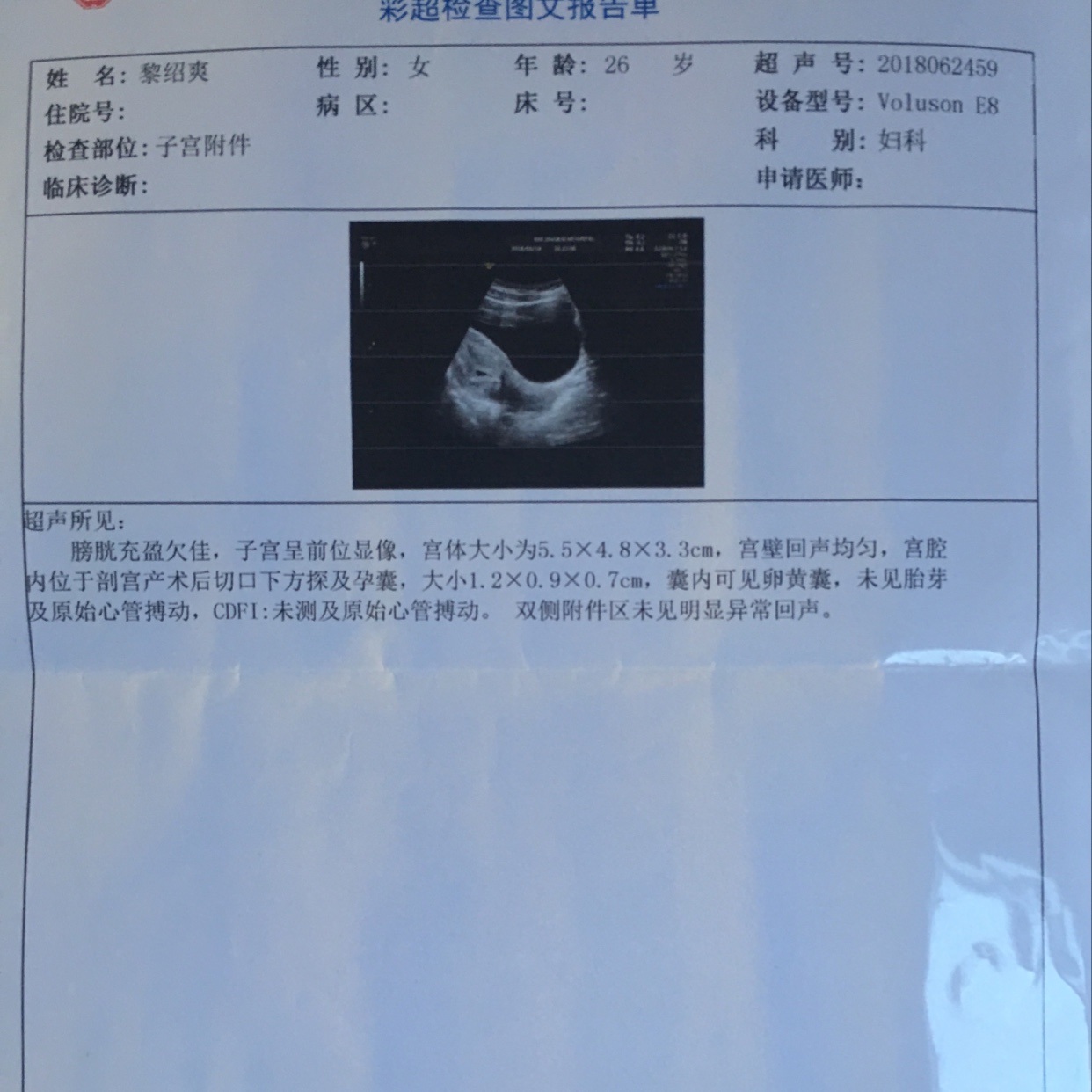 怀孕一个月内可以药流吗
