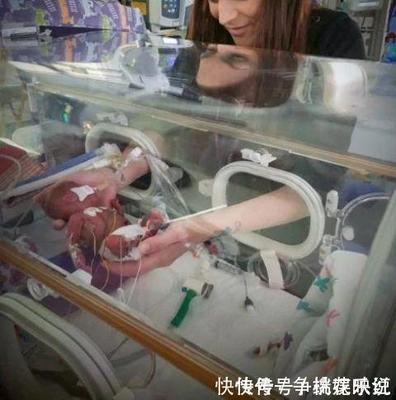 怀孕吸氧