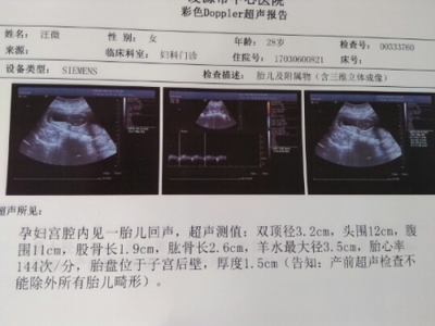 十七周胎儿
