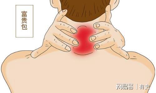 颈椎长个包是怎么回事