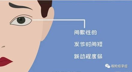 眼痉挛怎么治疗