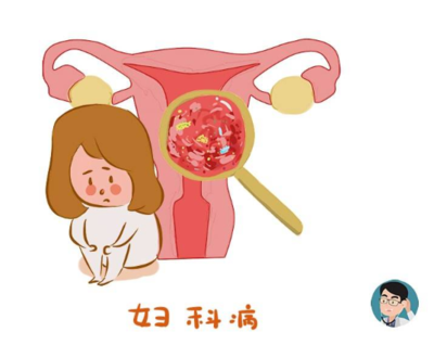 排卵期左下腹痛