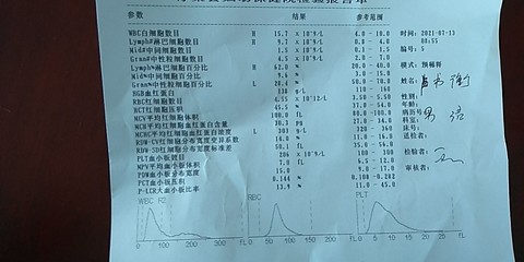 新生儿淋巴细胞绝对值偏高
