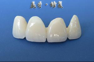 贵金属烤瓷牙的危害