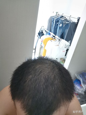 两个月头发长多长