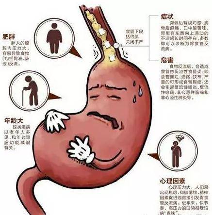 食道反酸是怎么回事