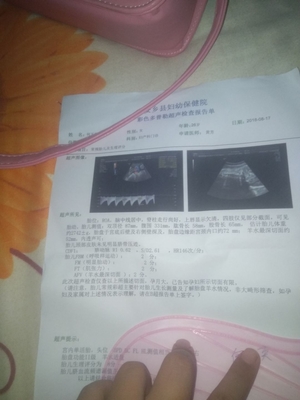 怀孕多少周可以做人流