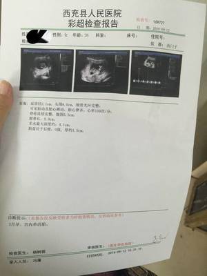 怀孕三个月宝宝
