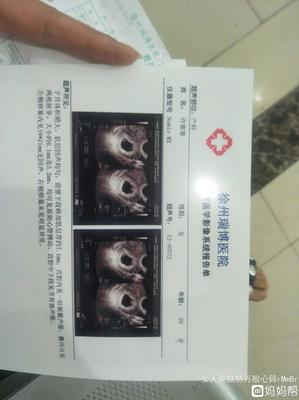 带环怀孕了怎么做流产