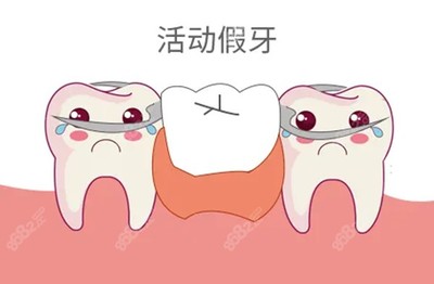镶一个烤瓷牙多少钱