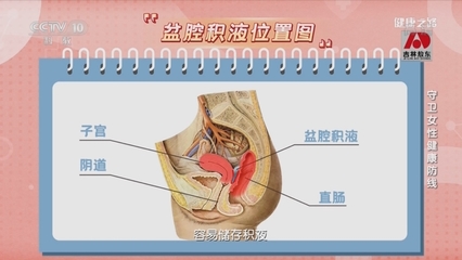 子宫有少量积液怎么办