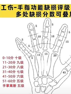 手指工伤十级伤残标准