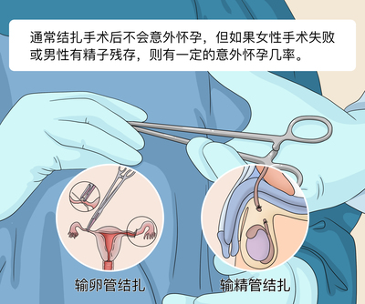 做了结扎还会怀孕吗