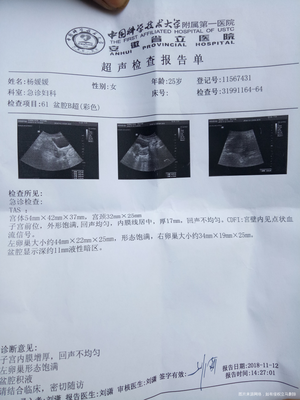 怀孕一个月胎儿有多大