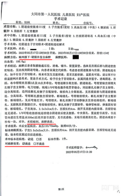 子宫切除会老的很快吗