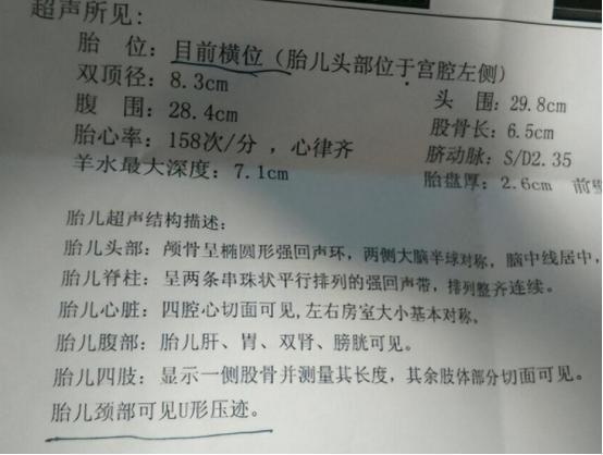 胎儿死亡赔偿标准