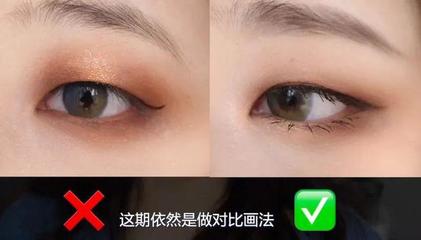 单眼皮变内双