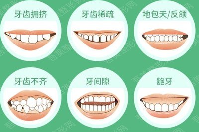 牙齿紧绷是怎么回事