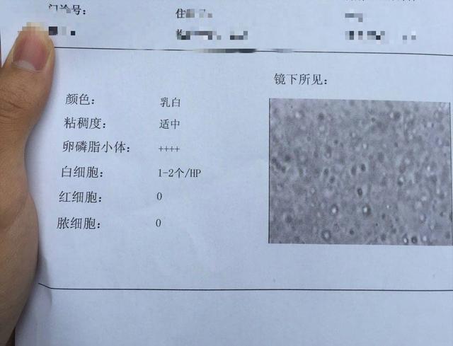 前列腺液怀孕几率大吗