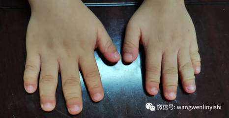 男人手指粗短是什么命
