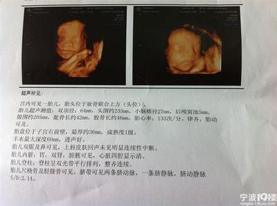 37周宝宝发育标准