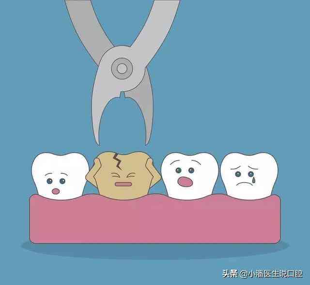 蛀牙牙齿疼