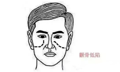 男人脸颊凹陷面相运势