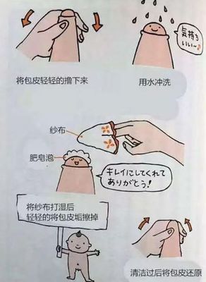 手动包皮粘连分离清洗多少钱