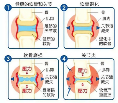 经常浑身疼是怎么回事