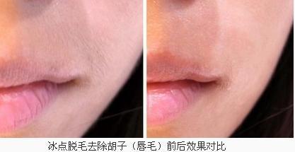 长痘痘能脱唇毛