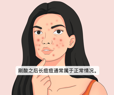 右脸颊为什么会长痘痘